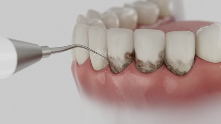 Trusted Wisdom Tooth Removal service in Mountain Home, ID - Dentist Open Now